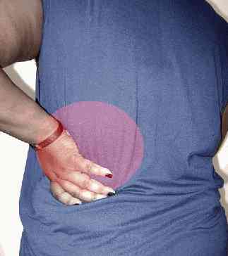 Dos d’une femme avec un cercle vers le bas, indiquant une douleur lombaire