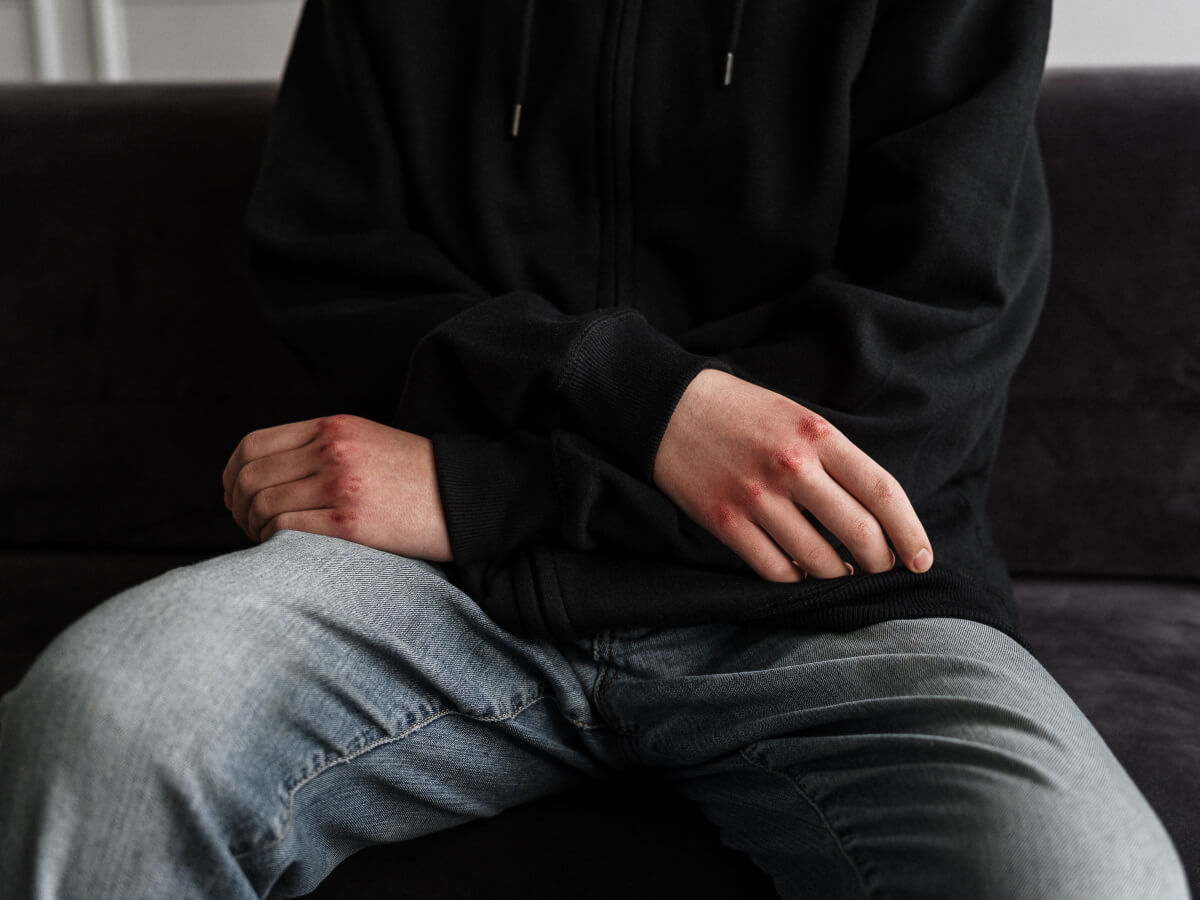 Un homme a les poings en sang parce qu'il a frappé quelqu'un.